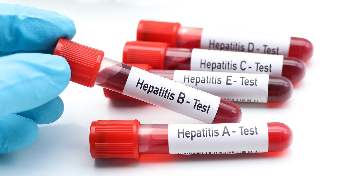 hepatitis-roehrchen-test-labor