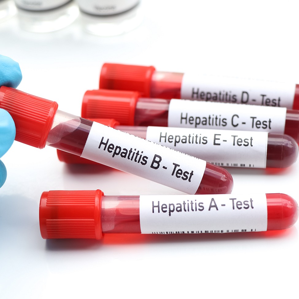 hepatitis-roehrchen-test-labor